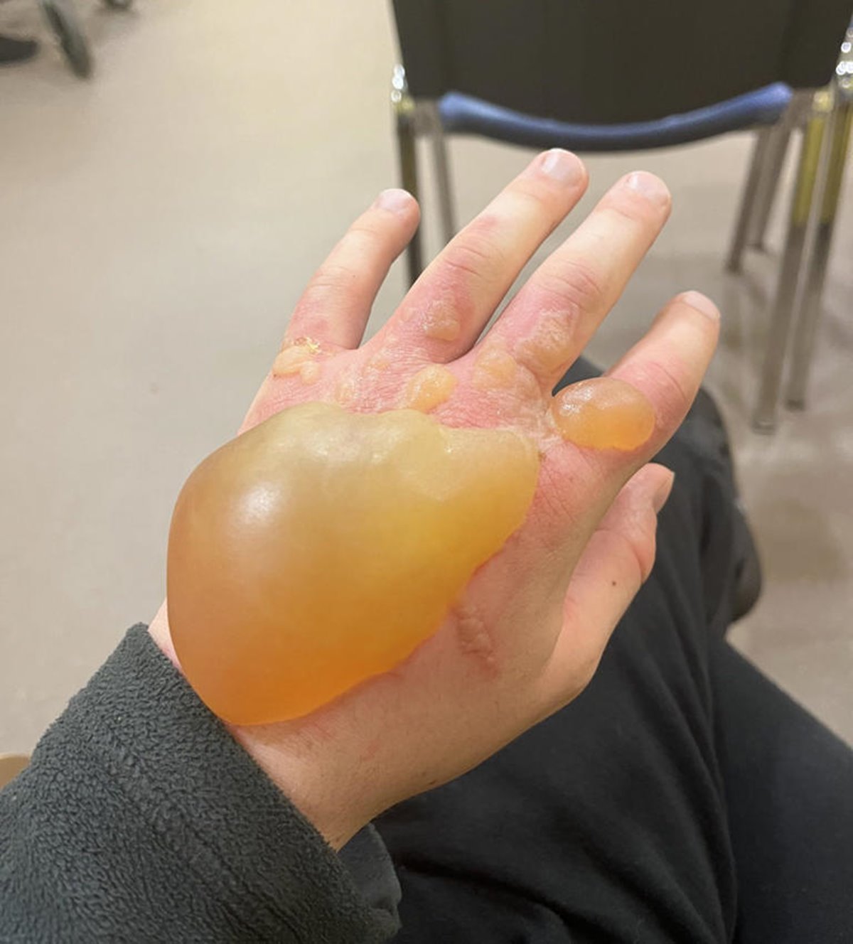 yaban-maydanozune-degen-cocugun-eli-sisti-3