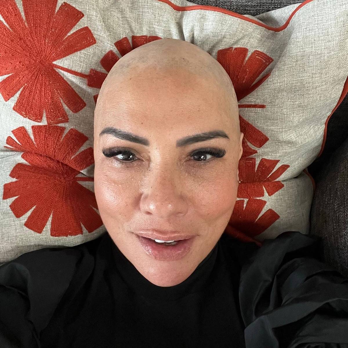 isin-karaca-saclarini-neden-kazitti