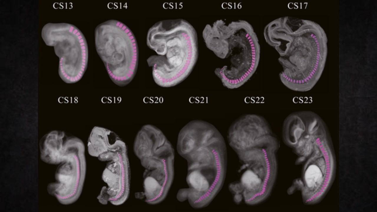 e42a9a76a9d2256b2cc9c93b25bd23520c5aa973