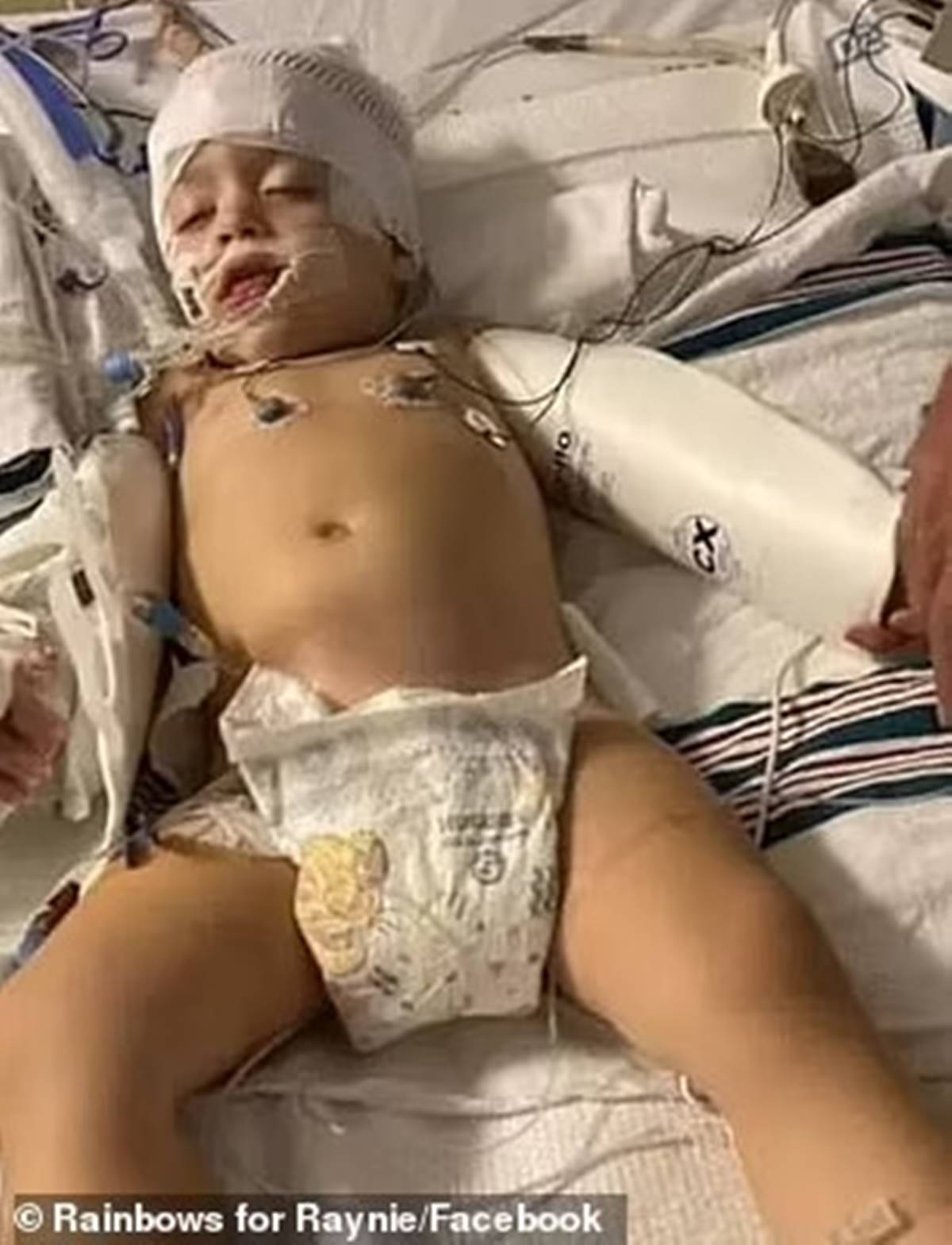 olumcul-virus-beynini-yedi-2-001