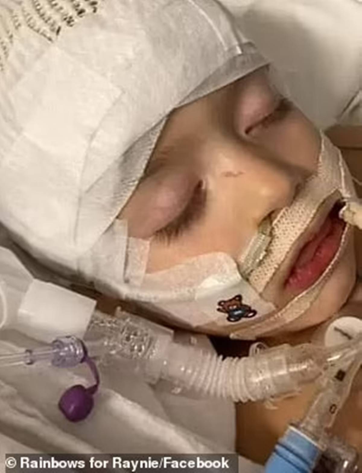 olumcul-virus-beynini-yedi-3