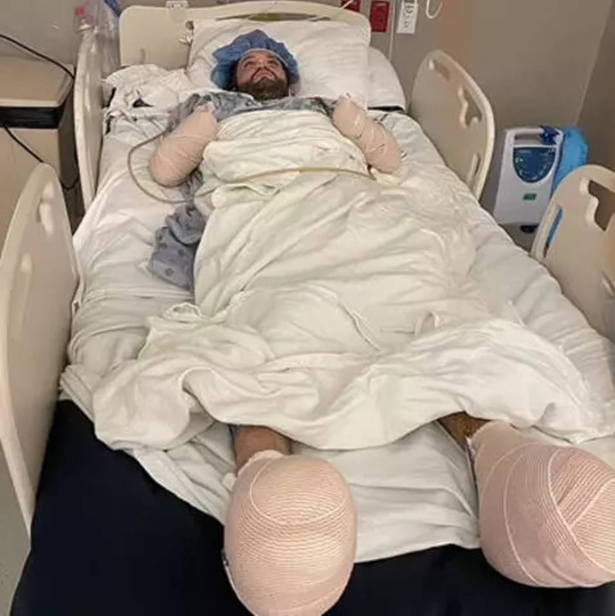 pirenin-isirdigi-adamin-el-ve-ayagi-kesildi-2