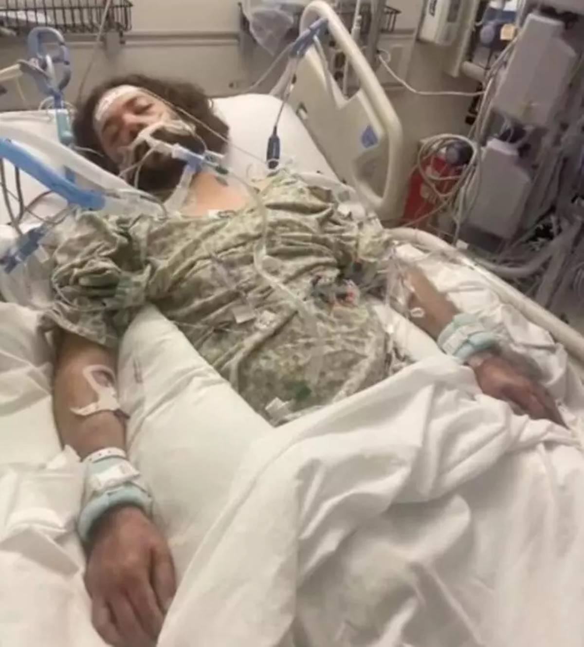 pirenin-isirdigi-adamin-el-ve-ayagi-kesildi-3