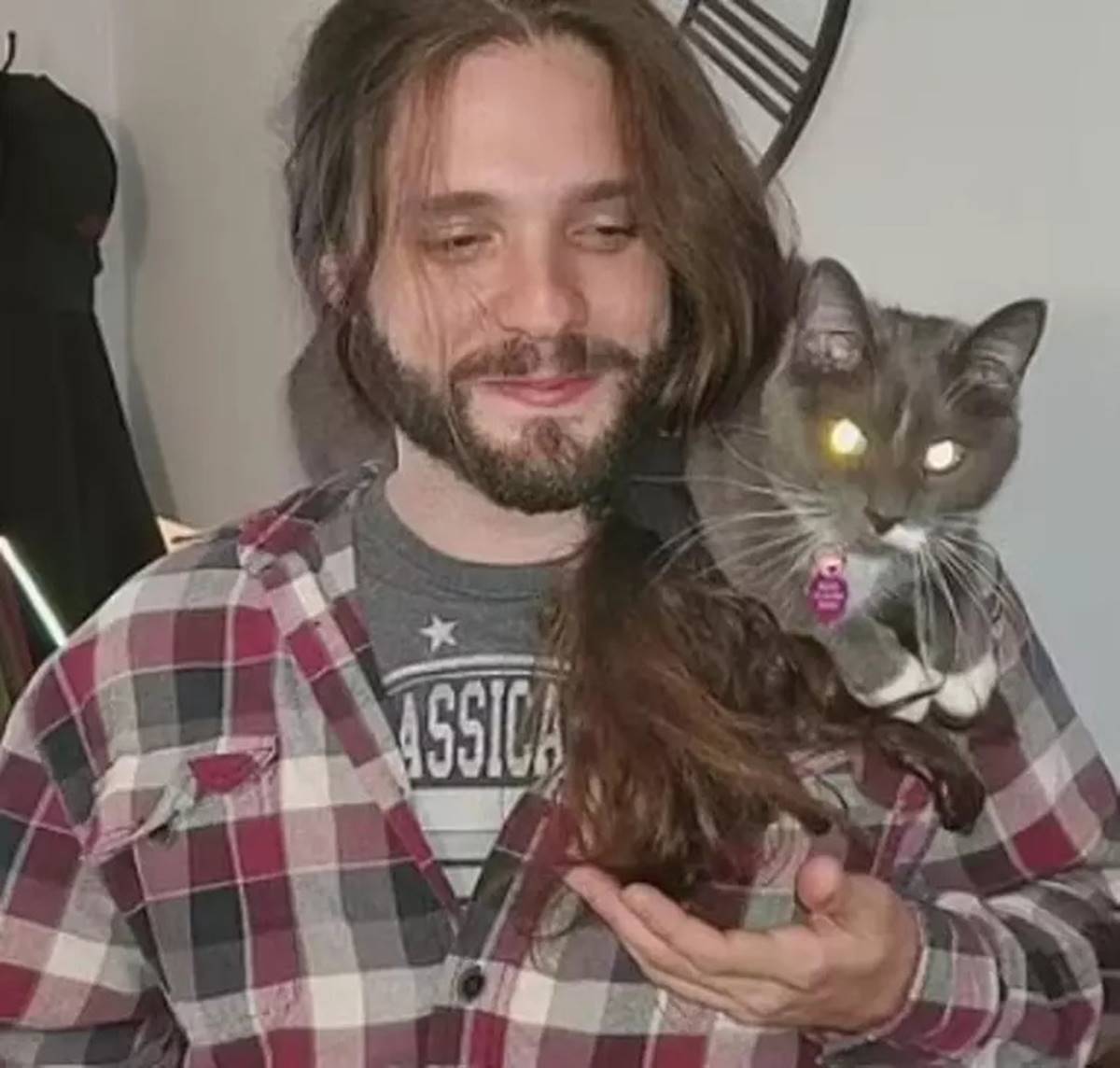 pirenin-isirdigi-adamin-el-ve-ayagi-kesildi-5