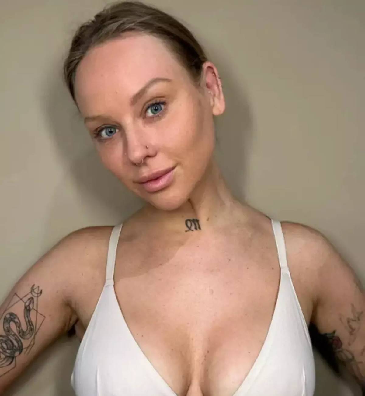 gogus-buyutme-ameliyatindan-sonra-koru-oldu-2