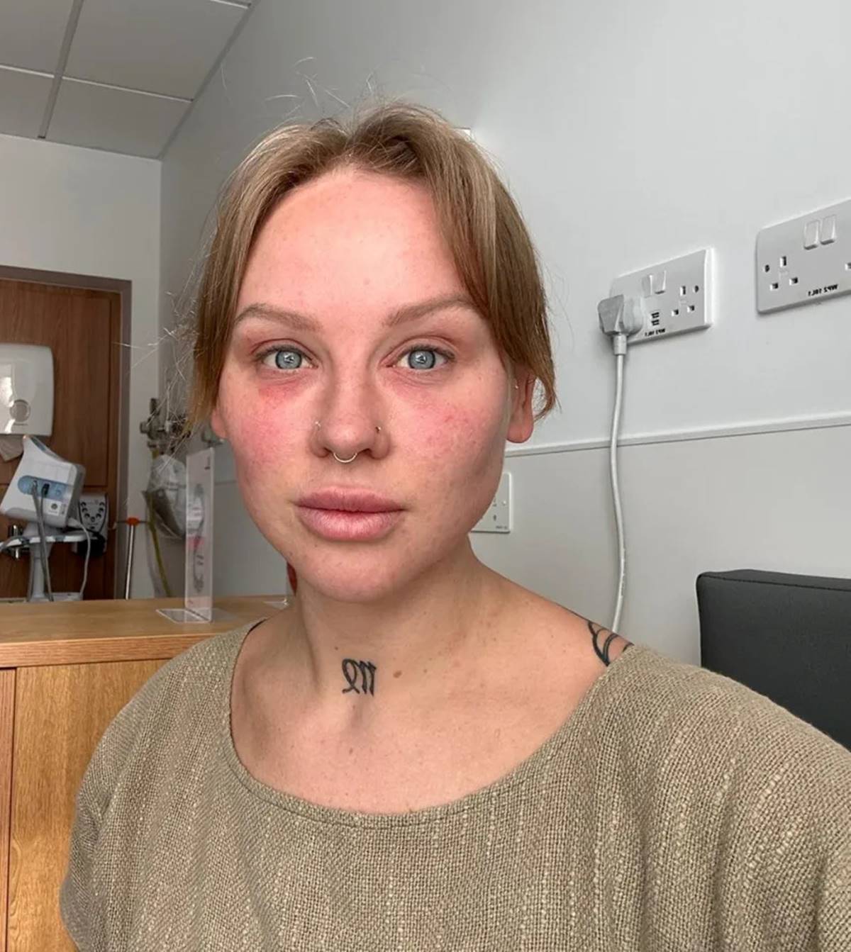 gogus-buyutme-ameliyatindan-sonra-koru-oldu-3