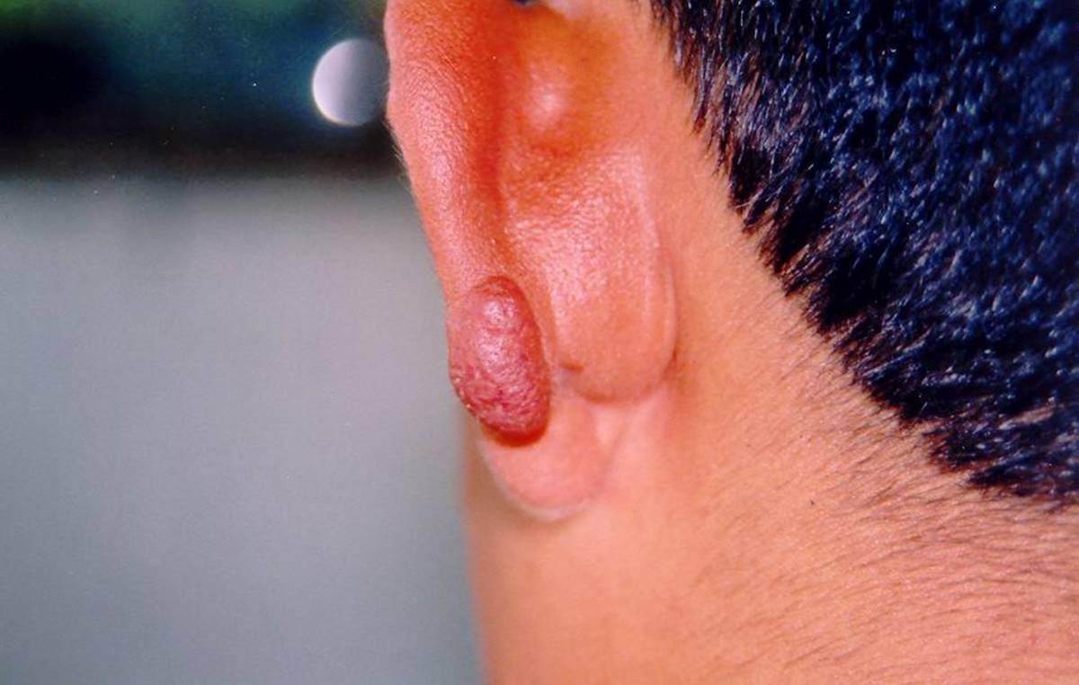 yakagan-sinekleri-zararlari-neler-3