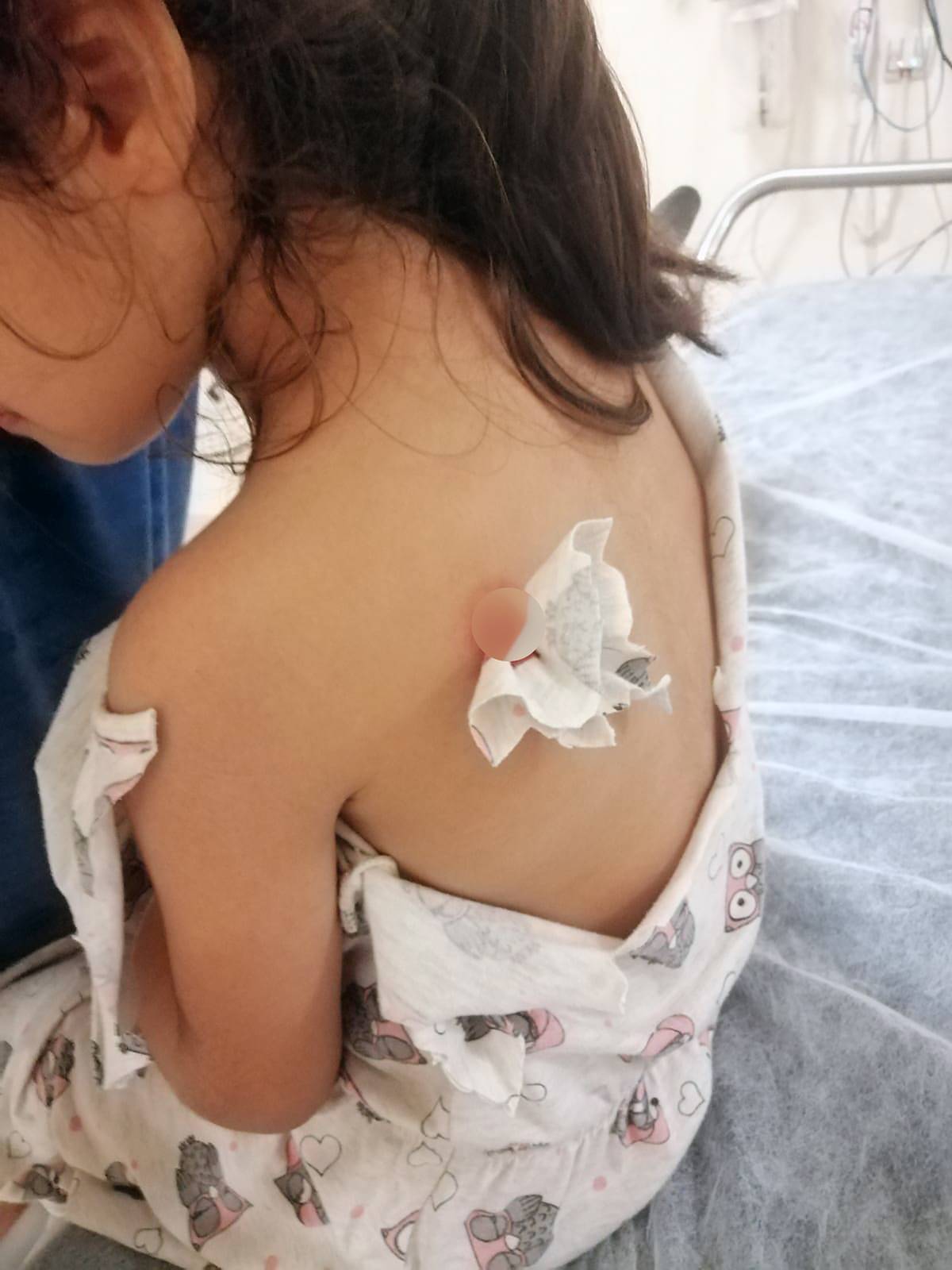 yorgun-mermi-kizin-sirtina-saplandi-4