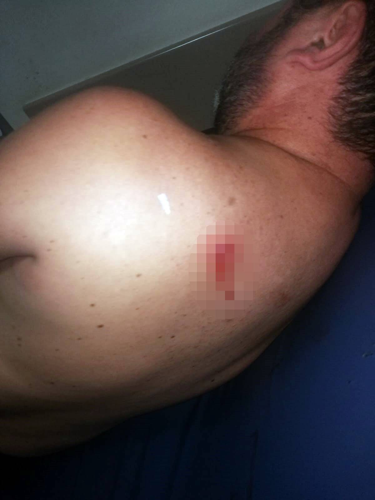 cay-icerken-sirtina-serseri-kursun-saplandi-12