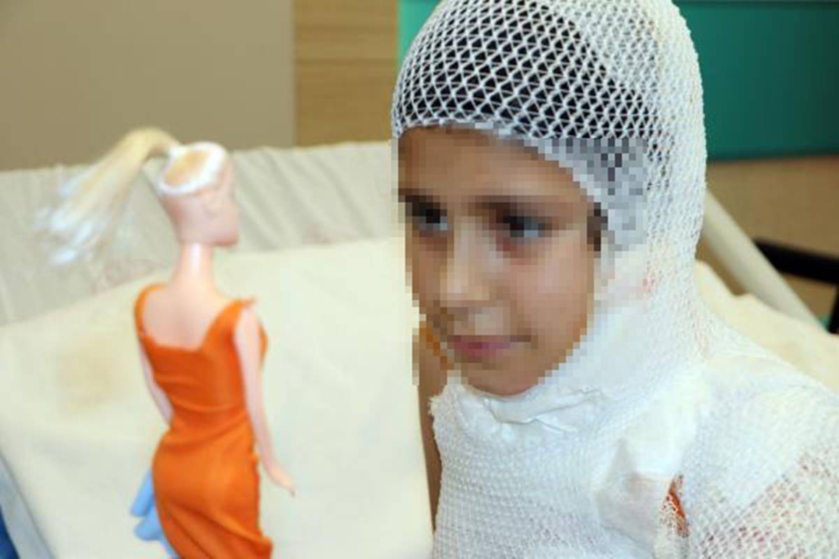 kolonya-yakma-deneyi-yaparken-yandi-2