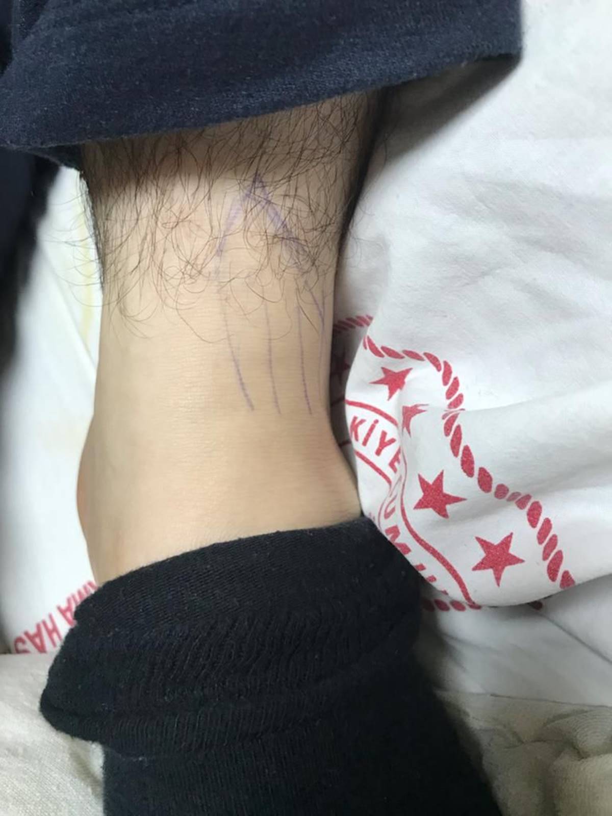 yanlis-ayagini-ameliyat-ettiler-1