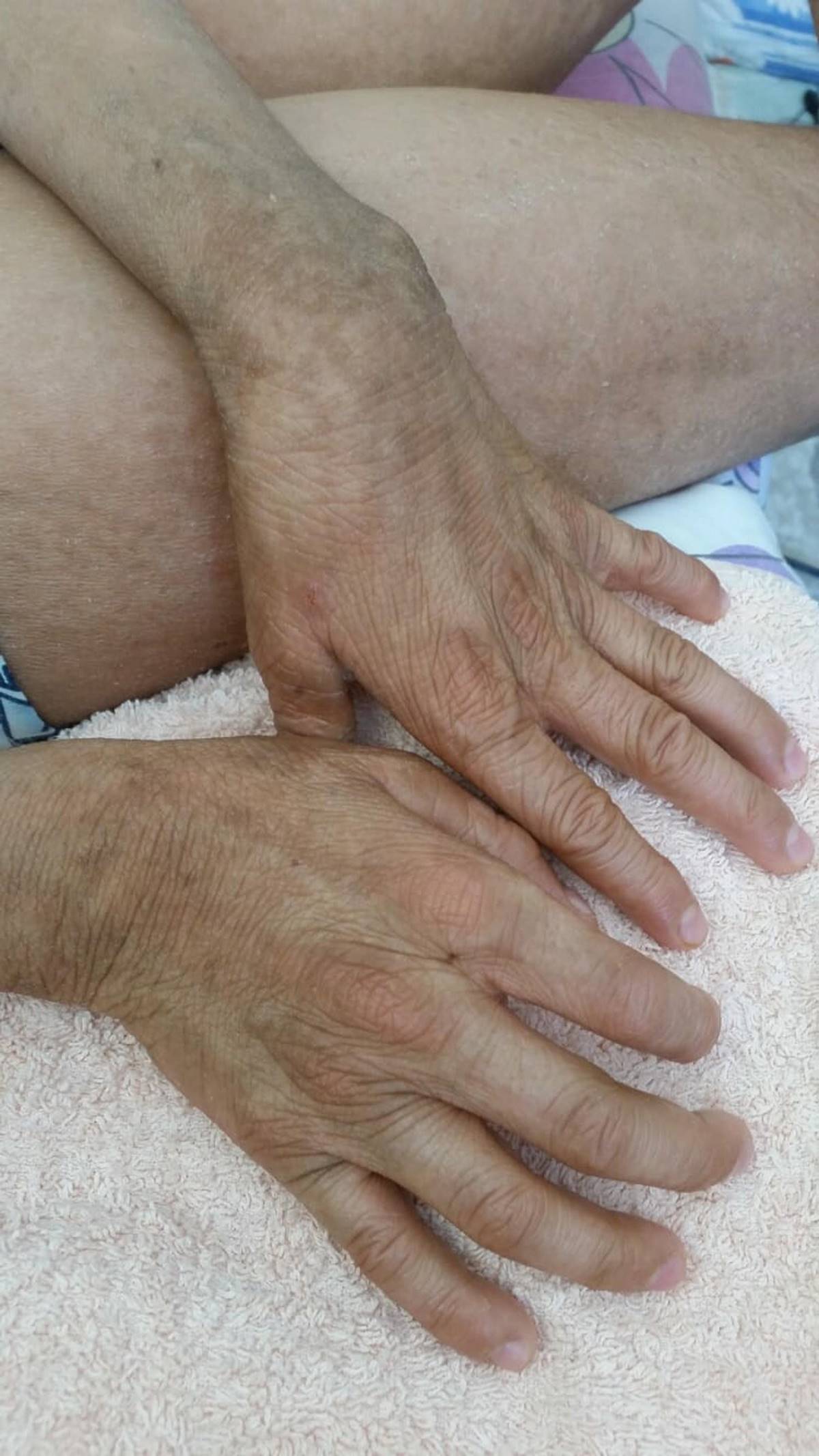 balik-pulu-hastasi-kayra-gunduzleri-evden-cikamiyor-3