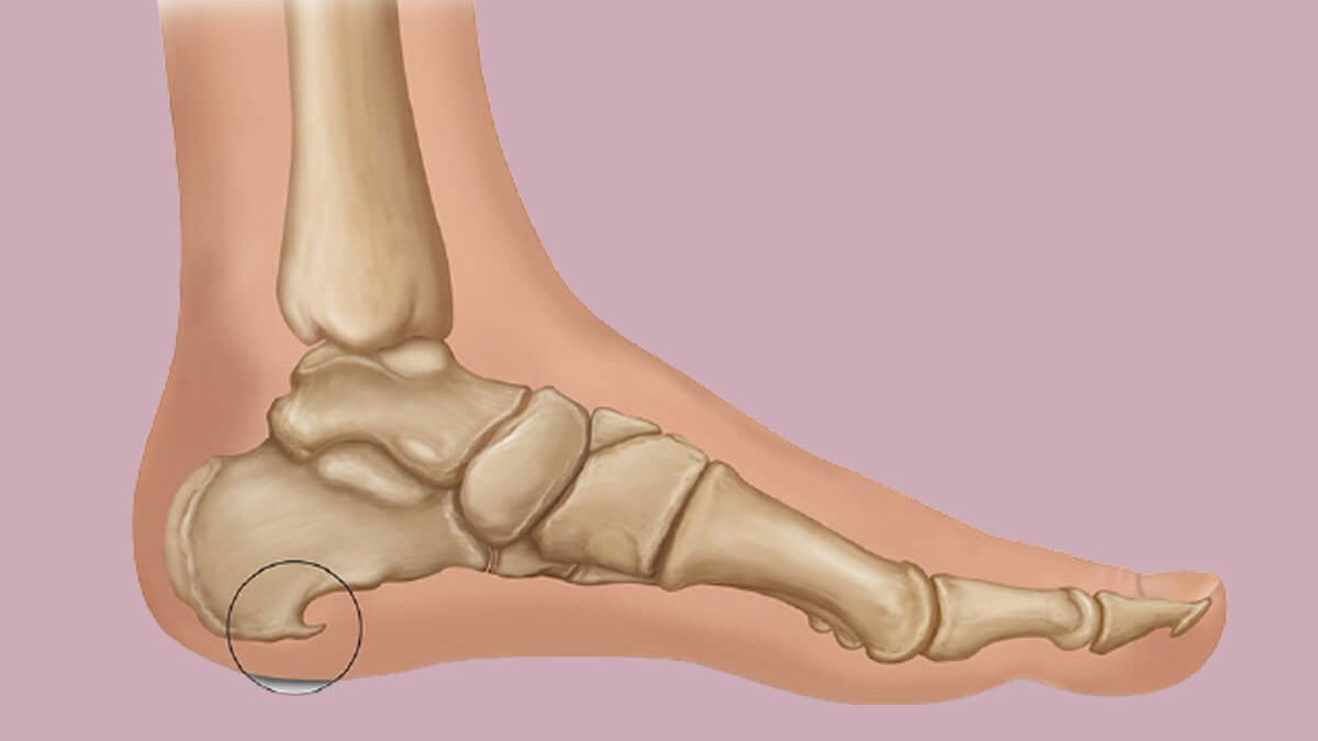 topuk-dikeni-1200x675