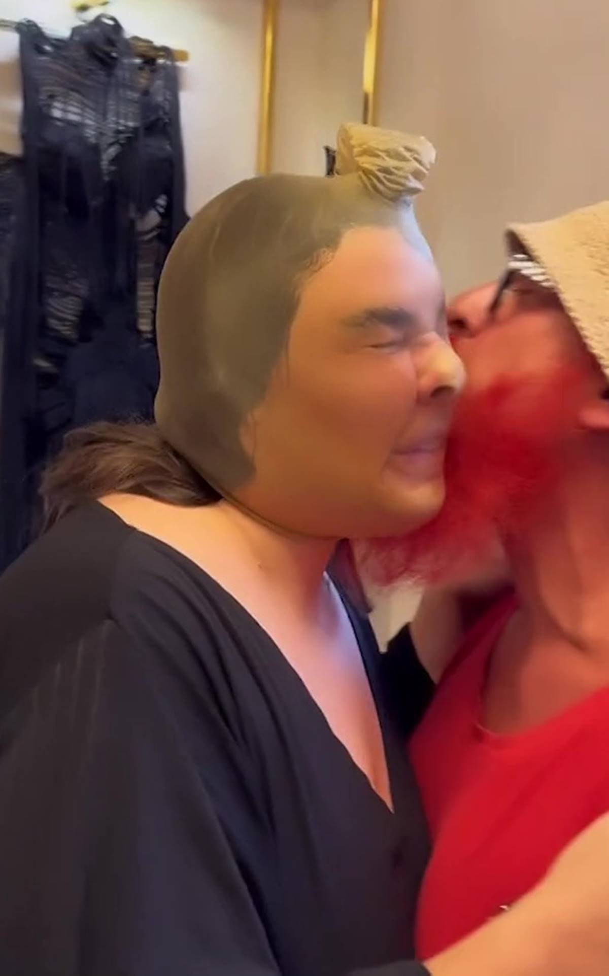 esra-dermancioglu-estetik-yaptiranlari-tiye-aldi-1