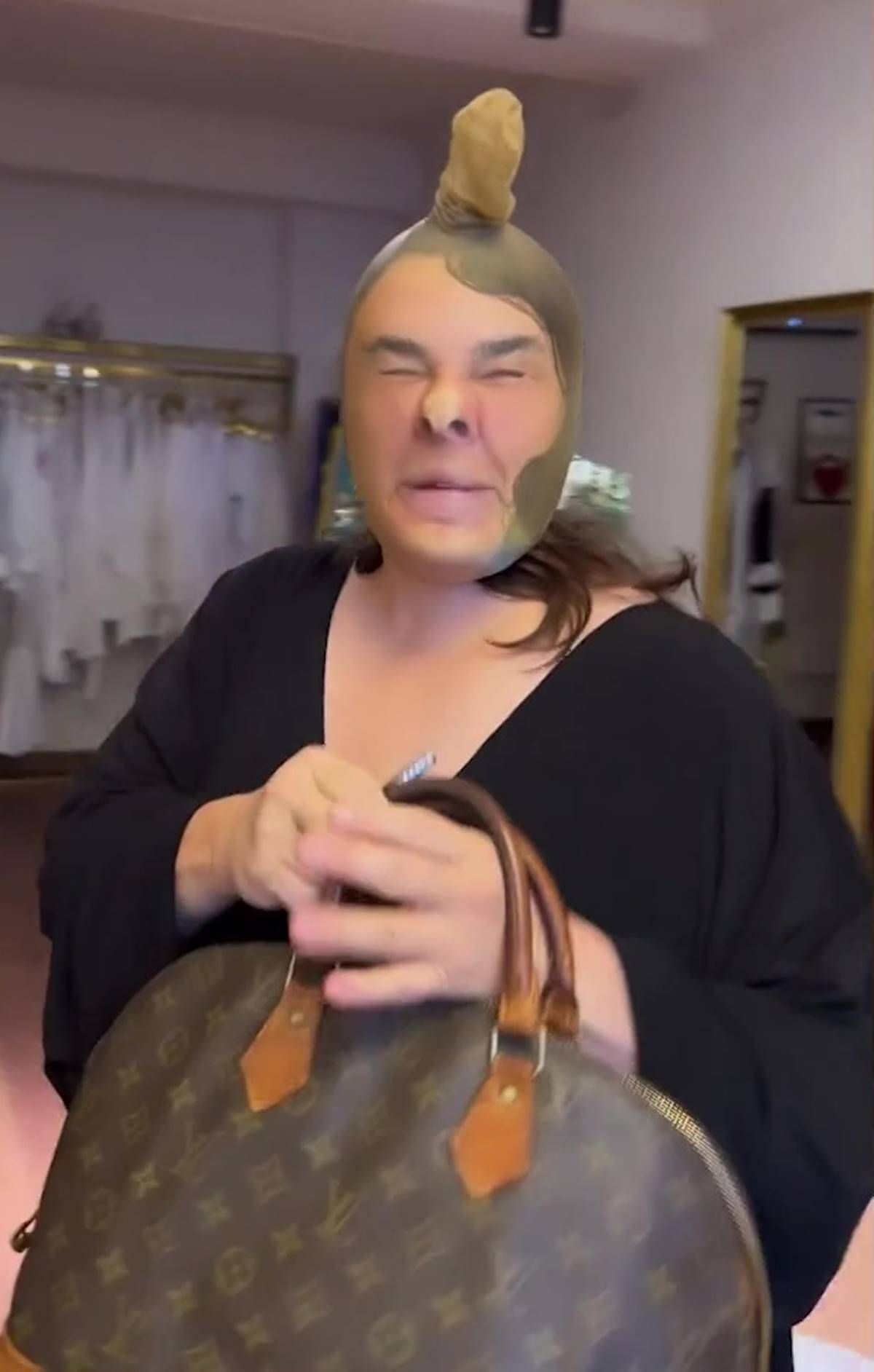 esra-dermancioglu-estetik-yaptiranlari-tiye-aldi-2