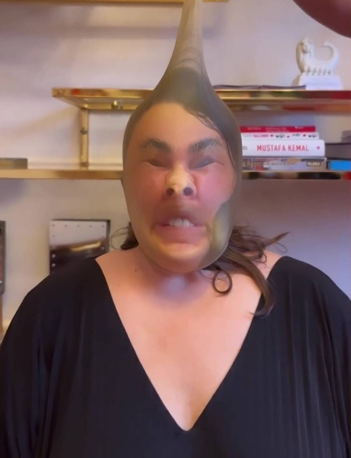 esra-dermancioglu-estetik-yaptiranlari-tiye-aldi-3