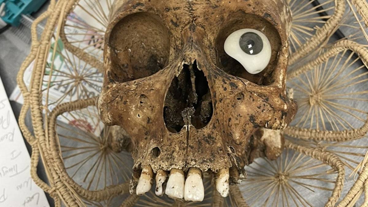 bagis-kutusundan-kuru-kafa-cikti-1