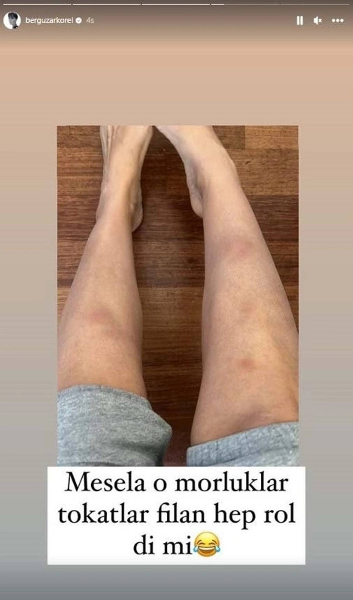 berguzar-korel-moraran-bacaklari-1