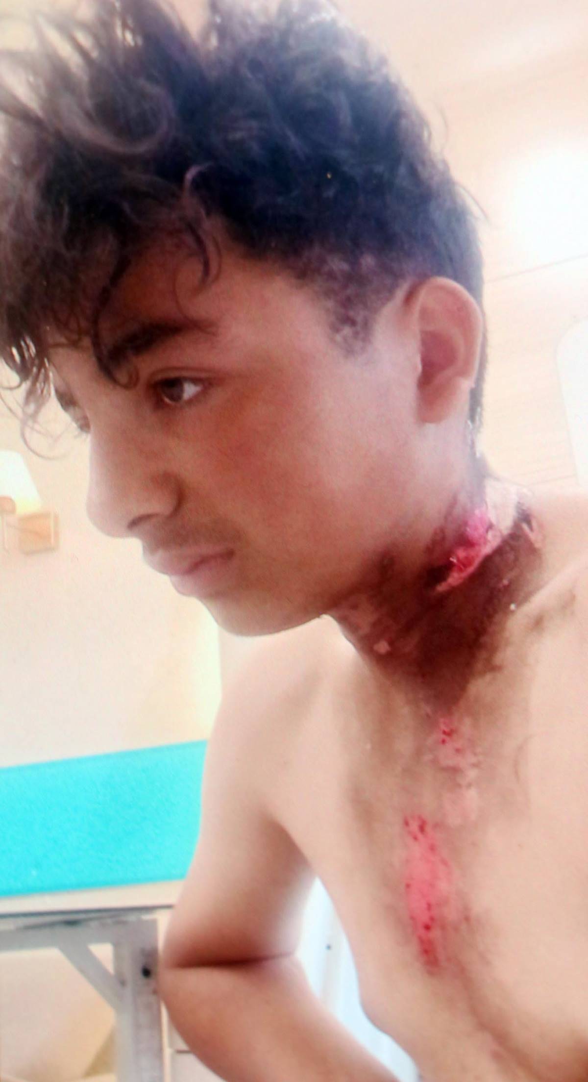 hayvan-otlatirken-uzerlerine-yildirim-dustu-2