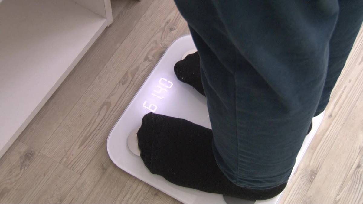 ameliyatsiz-5-ayda-60-kilo-verdi-2