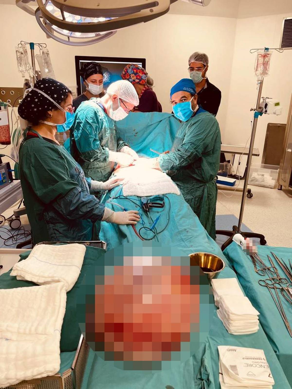 hamile-oldugunu-saniyordu-karnindan-15-kilo-kist-cikti-1