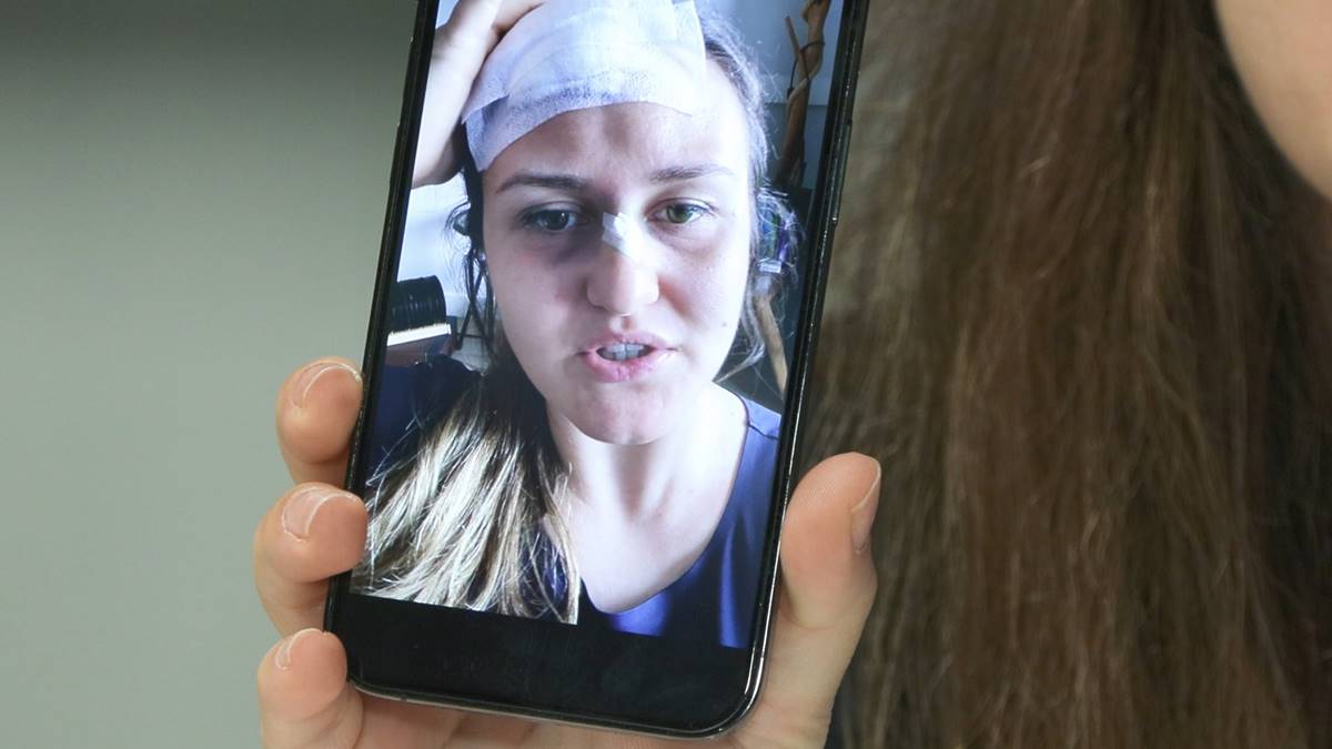 gokselin-konserindeki-kazayla-duyma-yetisini-yuzde-65-kaybetti-3