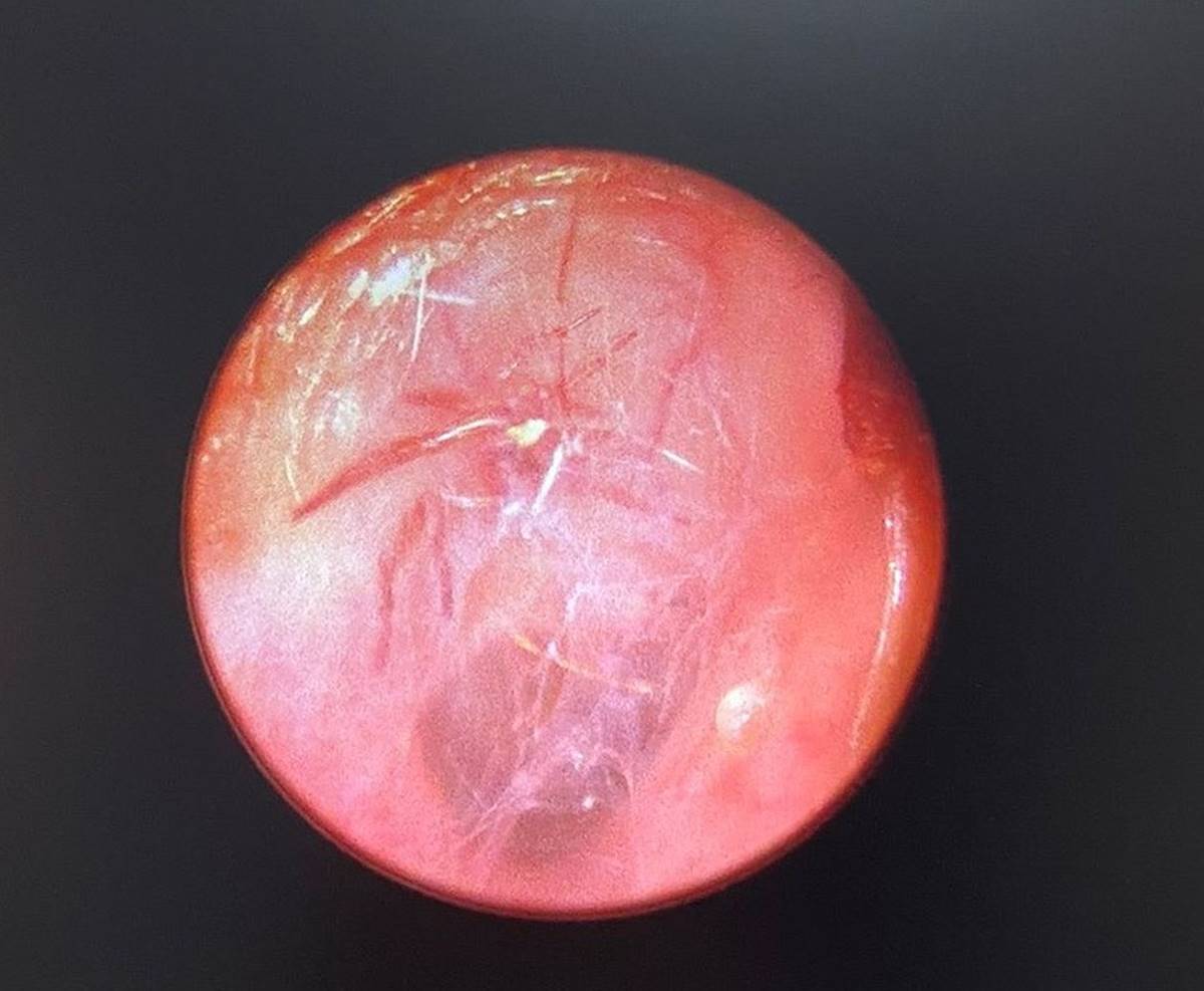 kulagindan-orumcek-cikti-1