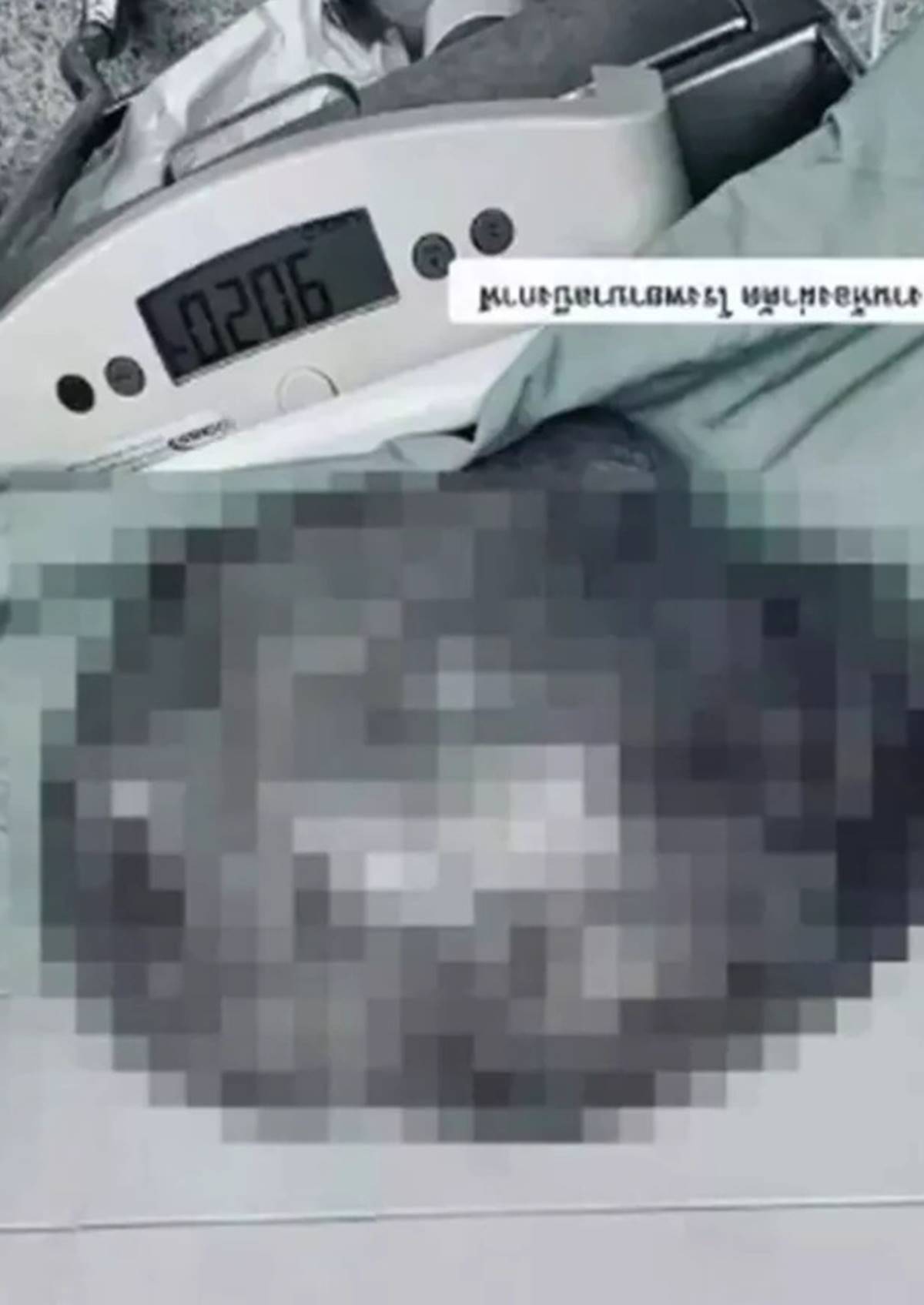 karnindan-dev-kitle-cikarildi