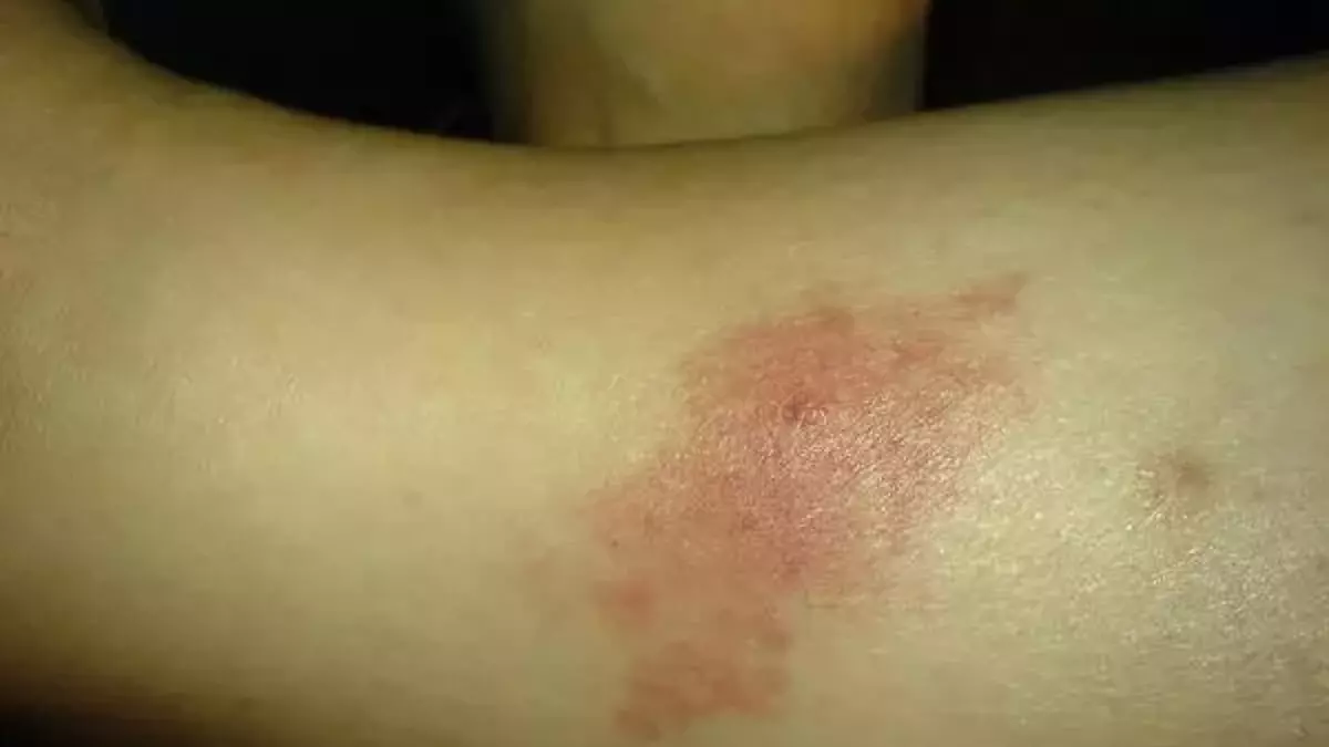 el-nino-kac-yil-surer-2