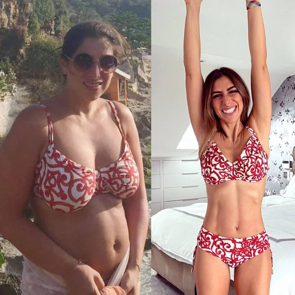 rachael-sacerdoti-before-after-3