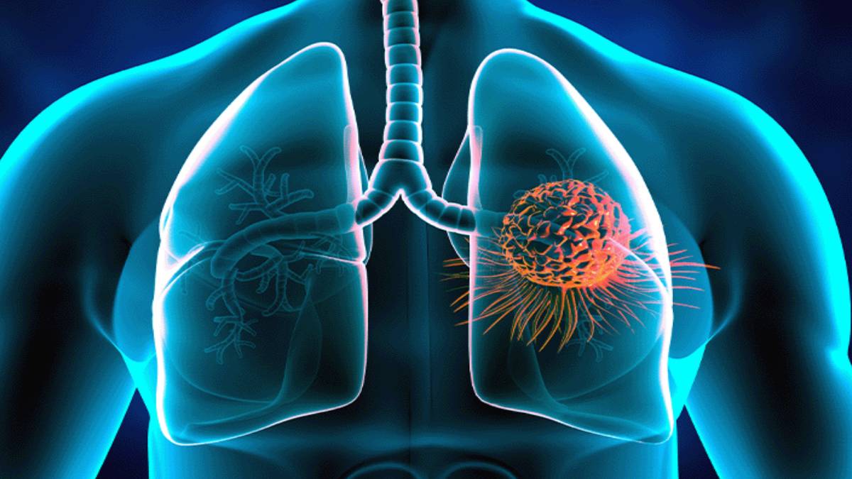 iste-insanlari-en-cok-olduren-hastalik-prof-dr-salih-topcu-ona-yakalanan-hastalar-1