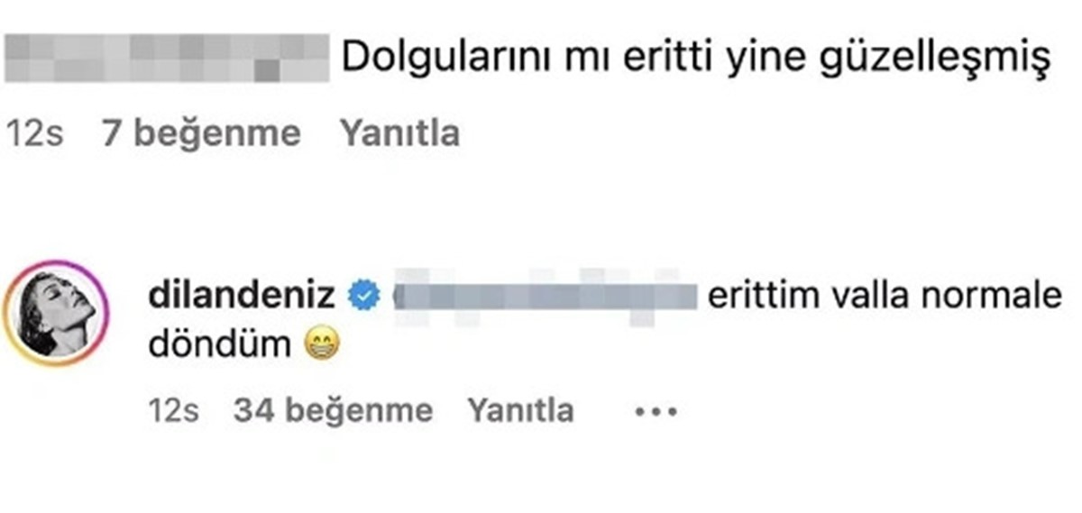 dilan-deniz-cicek-estetik-itirafi.jpg