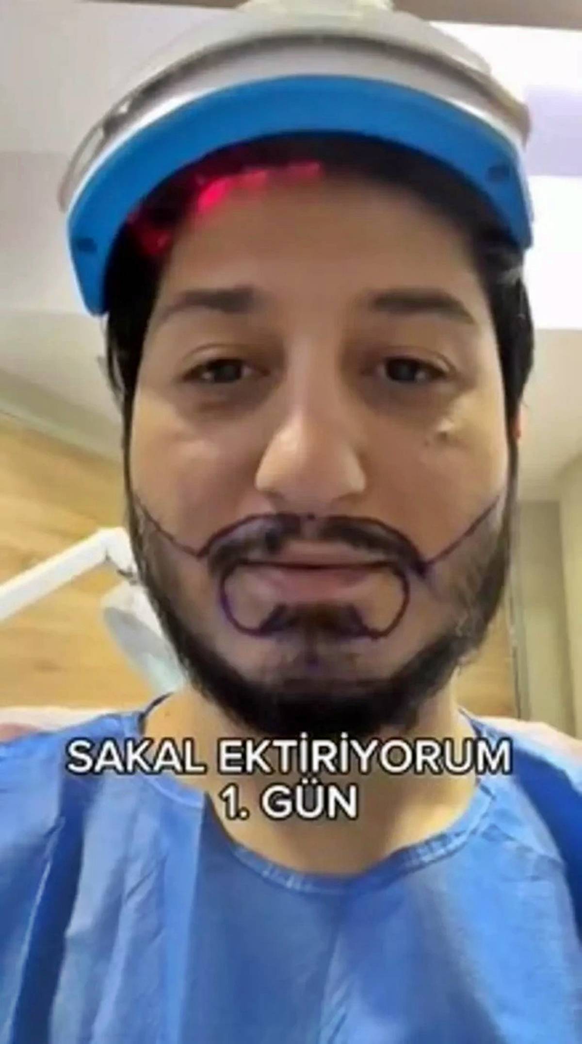 can-suoruc-sakal-ekimi-1.jpg