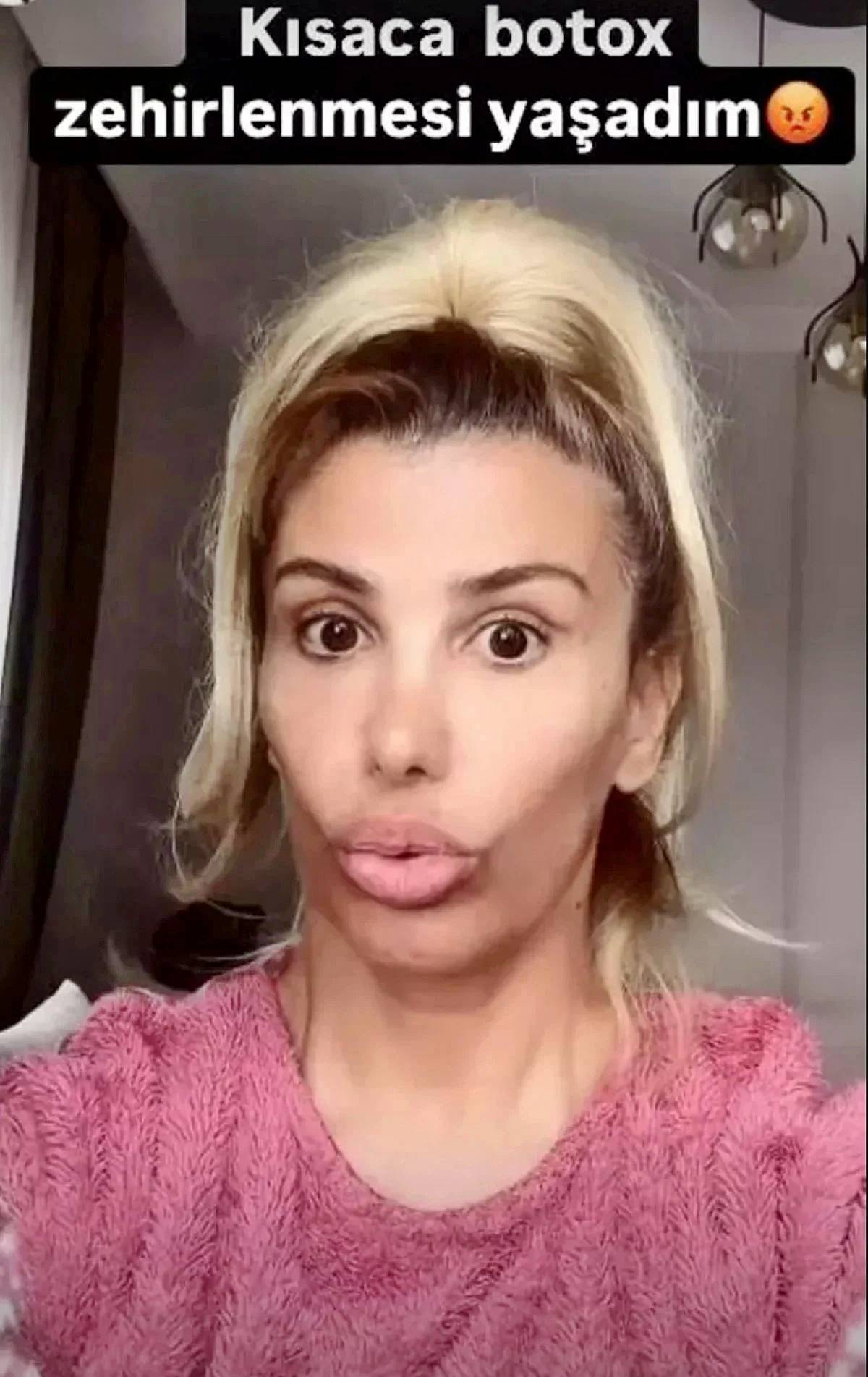 sarkici-hatice-estetikli-mi-nereleri-estetik-1