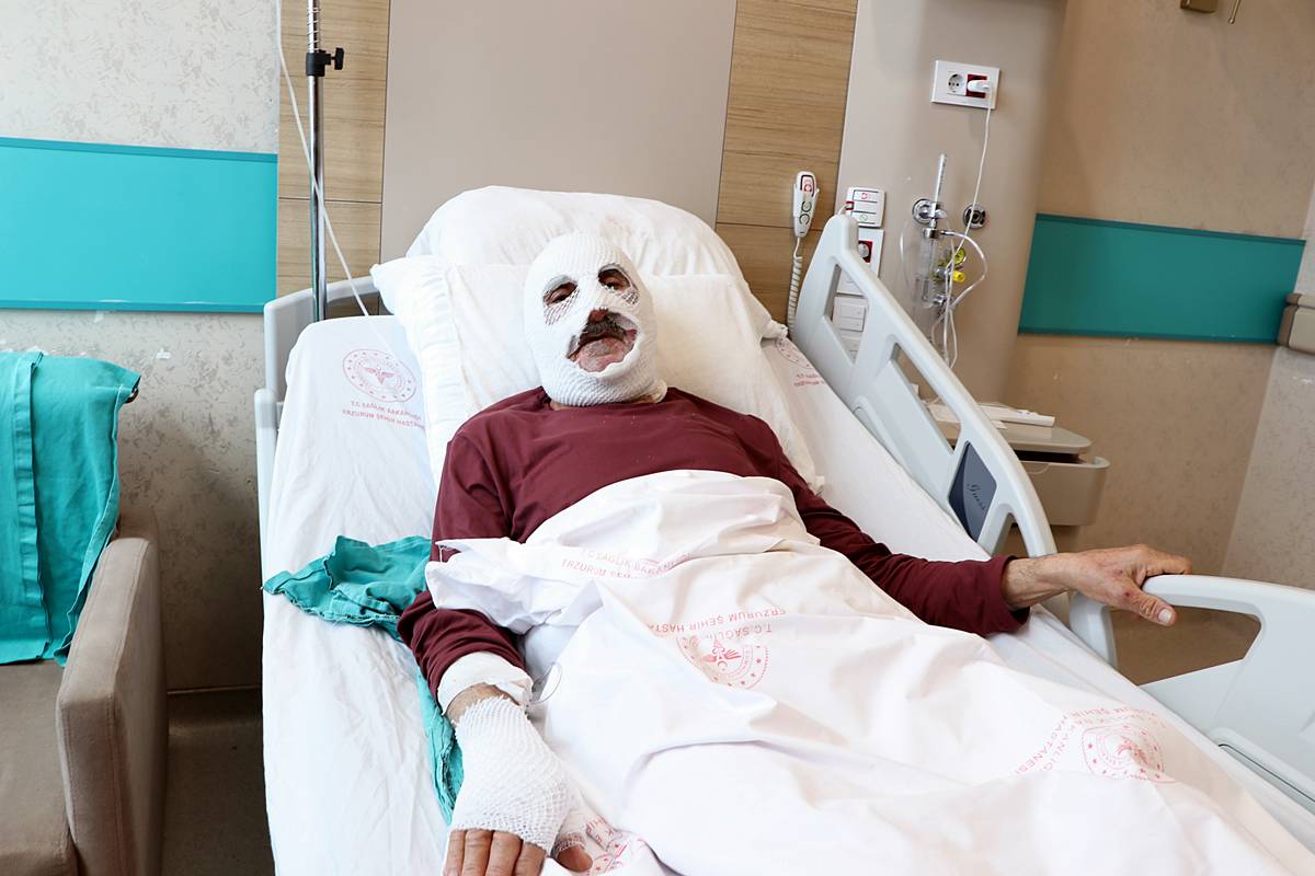 tup-gaz-kacagini-cakmakla-kontrol-etmek-dogru-mu-yanlis-mi-tehlikeli-mi-2.jpg