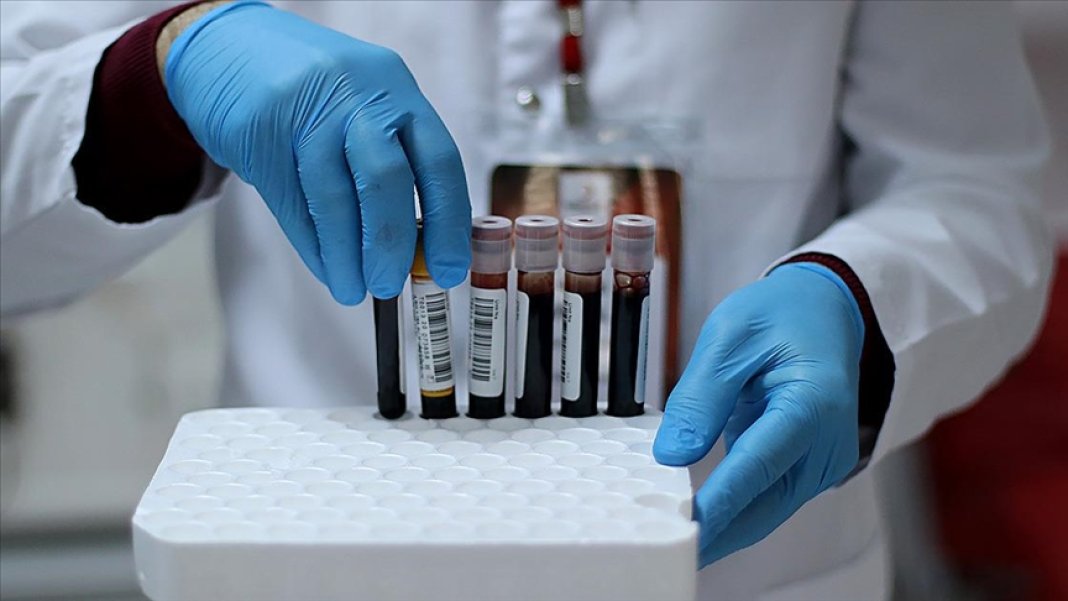 bu-kan-grubuna-sahip-olanlar-dikkat-alzheimer-riski-82-daha-fazla-1-001.jpg