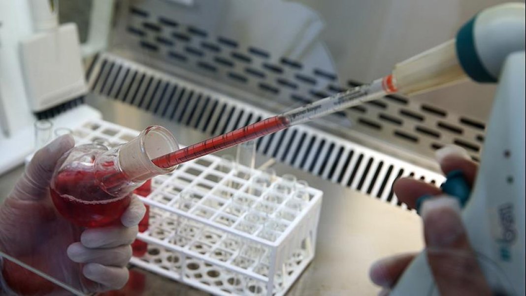 bu-kan-grubuna-sahip-olanlar-dikkat-alzheimer-riski-82-daha-fazla-2.jpg
