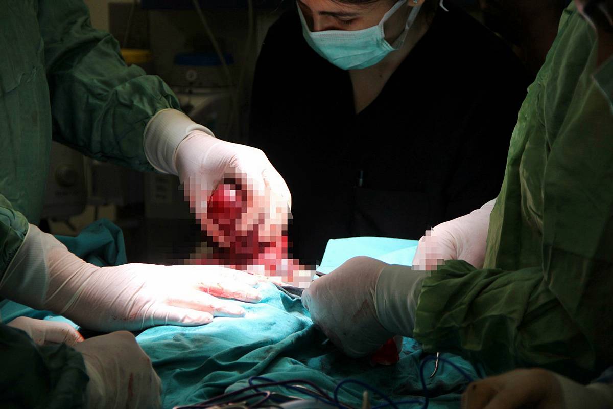 yeni-dogan-bebekte-tumor-olur-mu-bebekte-tumor-nasil-tedavi-edilir-8.jpg