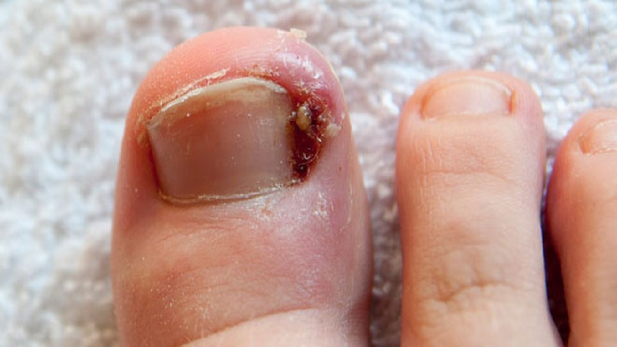 resim-2025-06-14-130633251