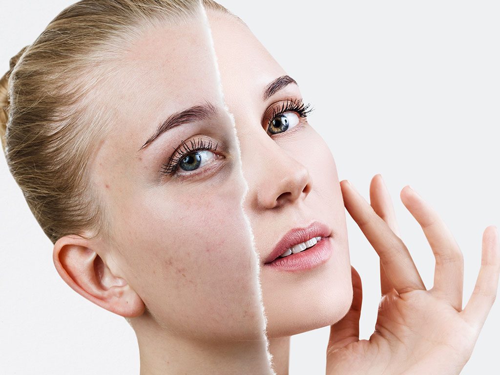 leke-tedavisi-1024x768