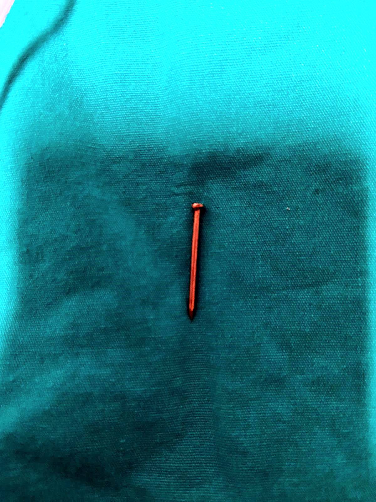 cocuk-civi-yutarsa-ne-yapilir-2