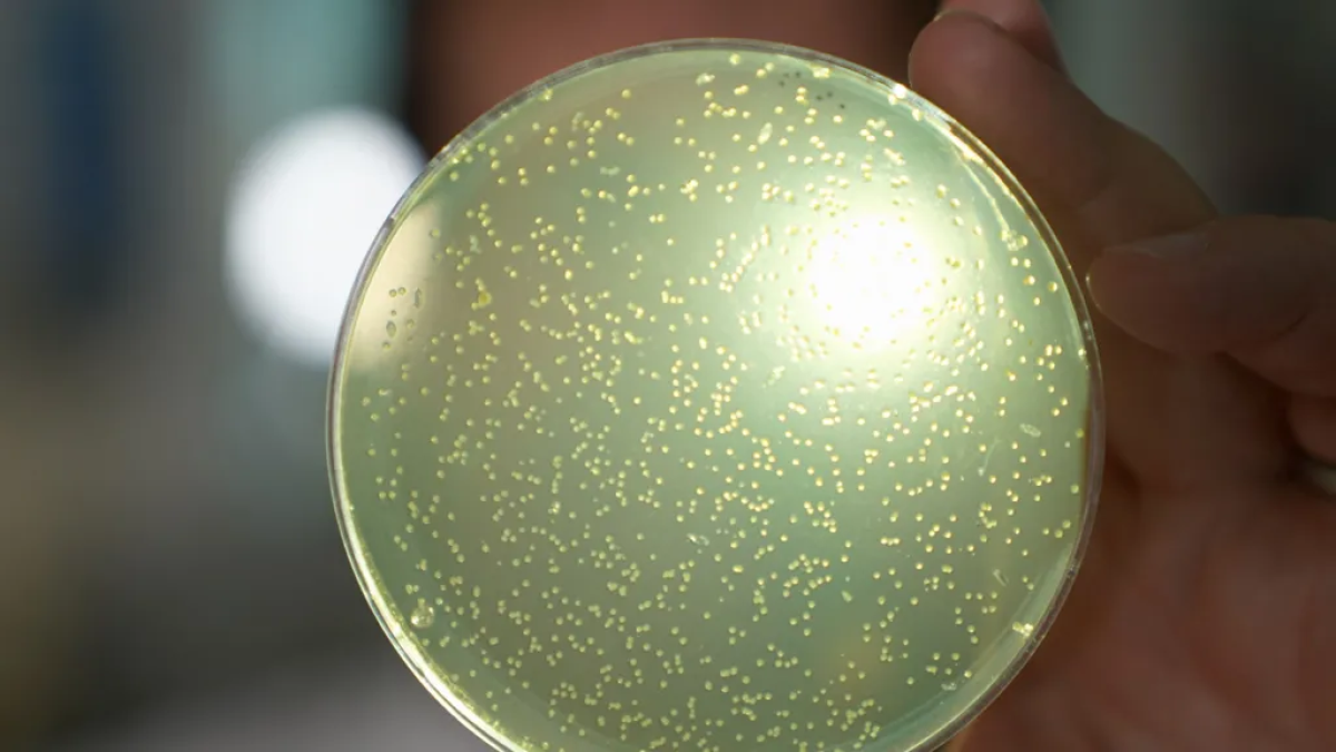 resim-2025-07-01-103849002