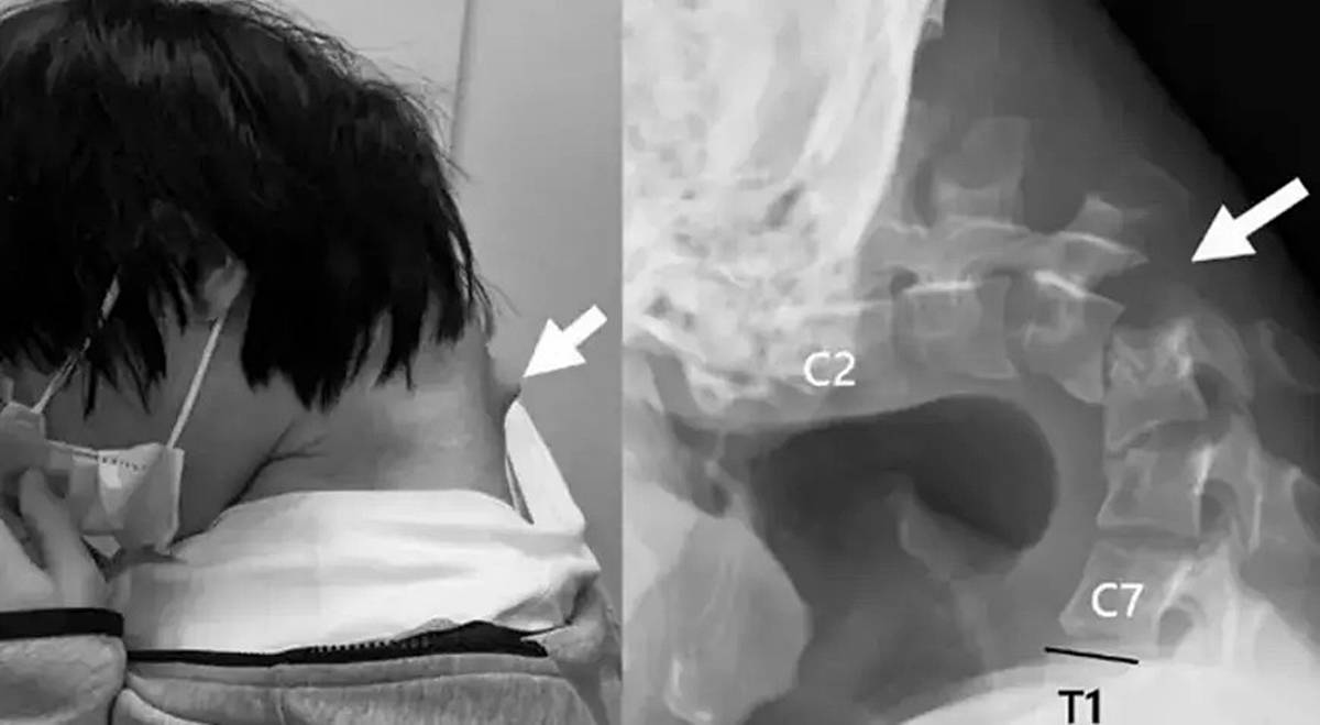 telefona-bakmak-boyun-agrisi-yapar-mi-1