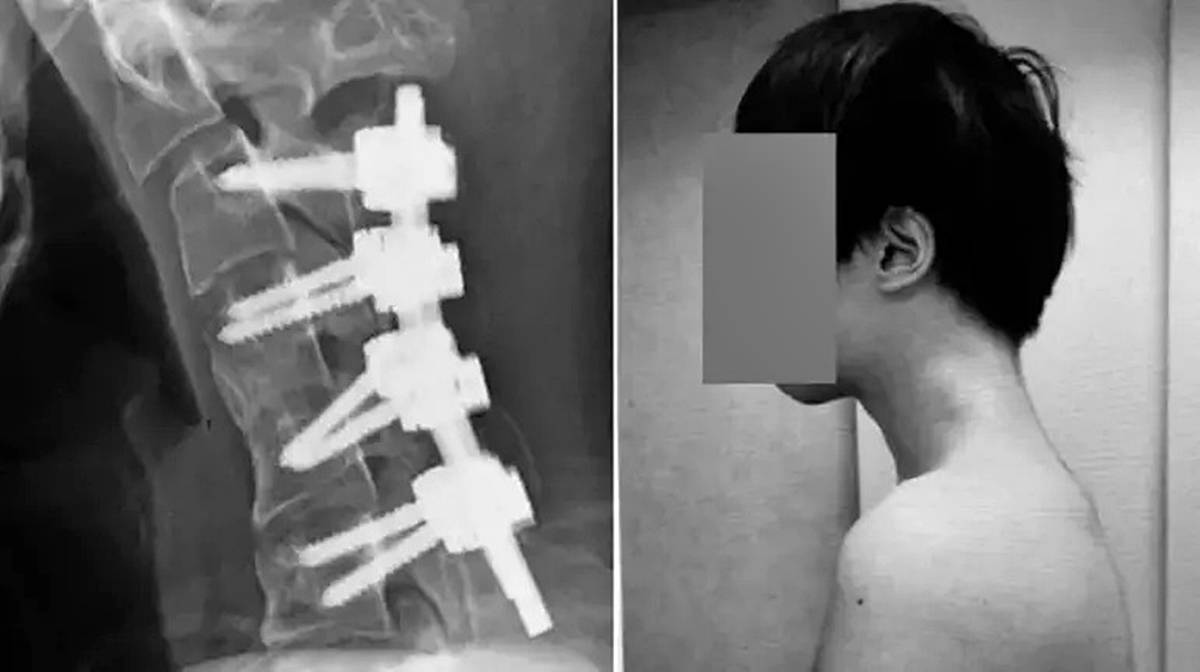 telefona-bakmak-boyun-agrisi-yapar-mi-2