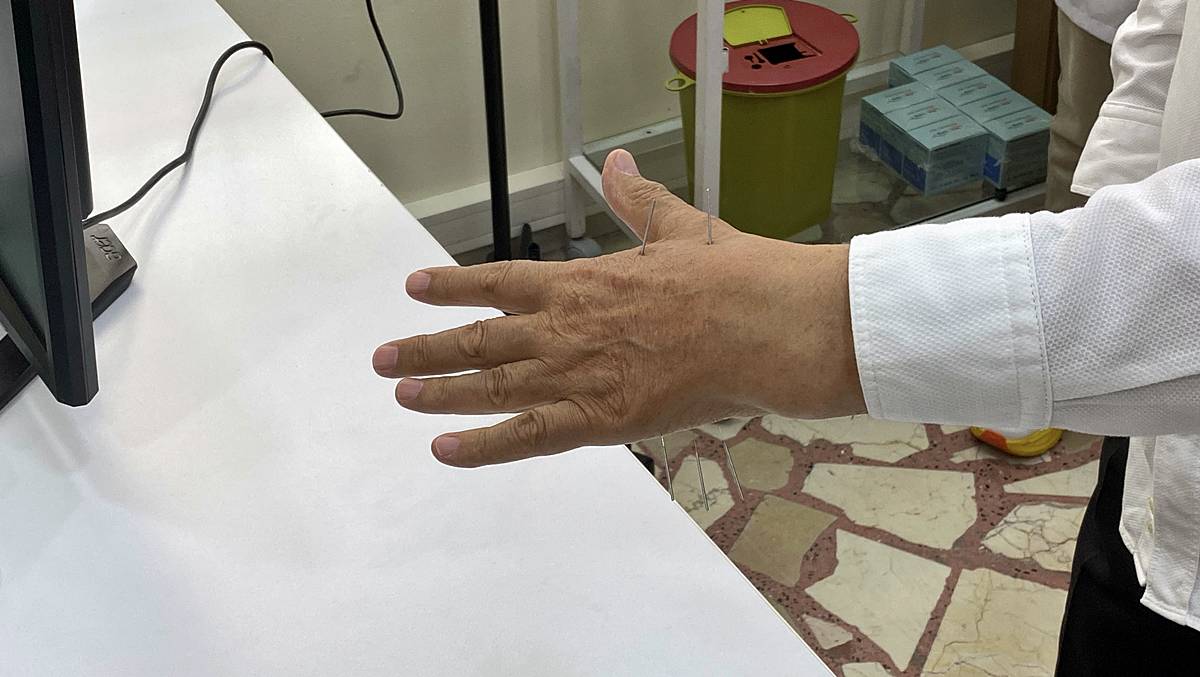 aile-hekimliginde-akupunktur-yapiliyor-mu-2