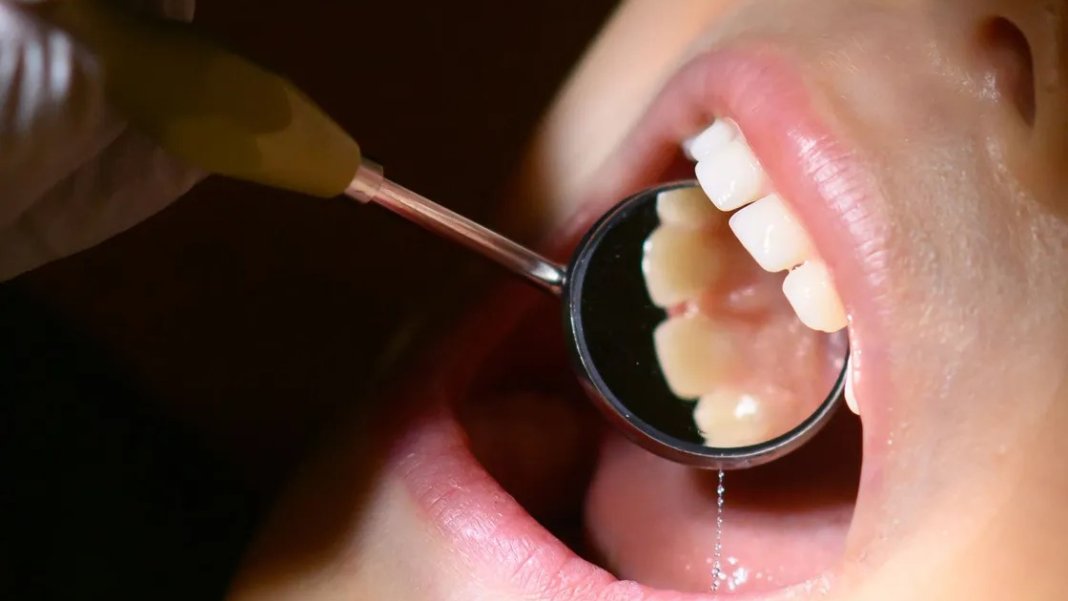 disleriniz-neden-kiriliyor-cocugunuzun-disleri-neden-gec-cikiyor-nedeni-sasirtabilir-2