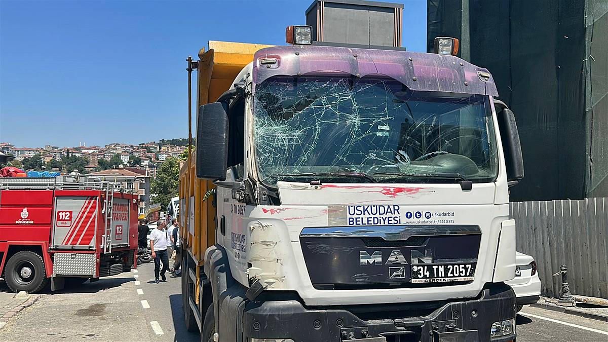 istanbul-uskudar-trafik-kazasi-motosiklet-surucusunun-bacagi-koptu-4