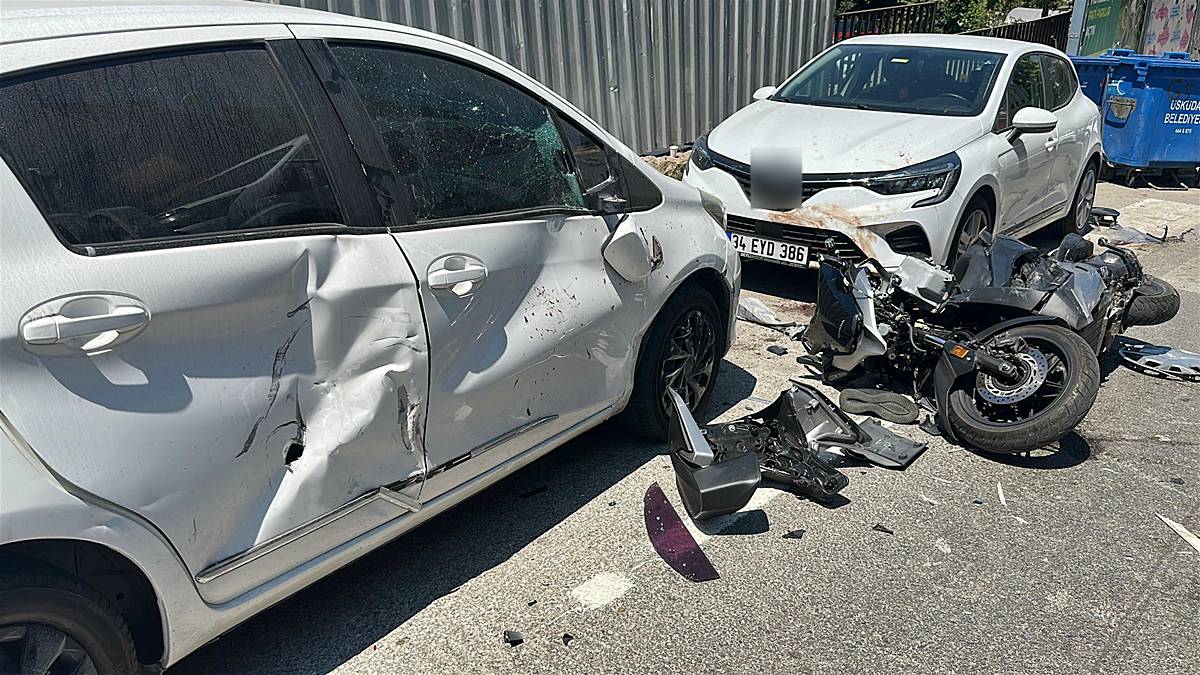 istanbul-uskudar-trafik-kazasi-motosiklet-surucusunun-bacagi-koptu-5