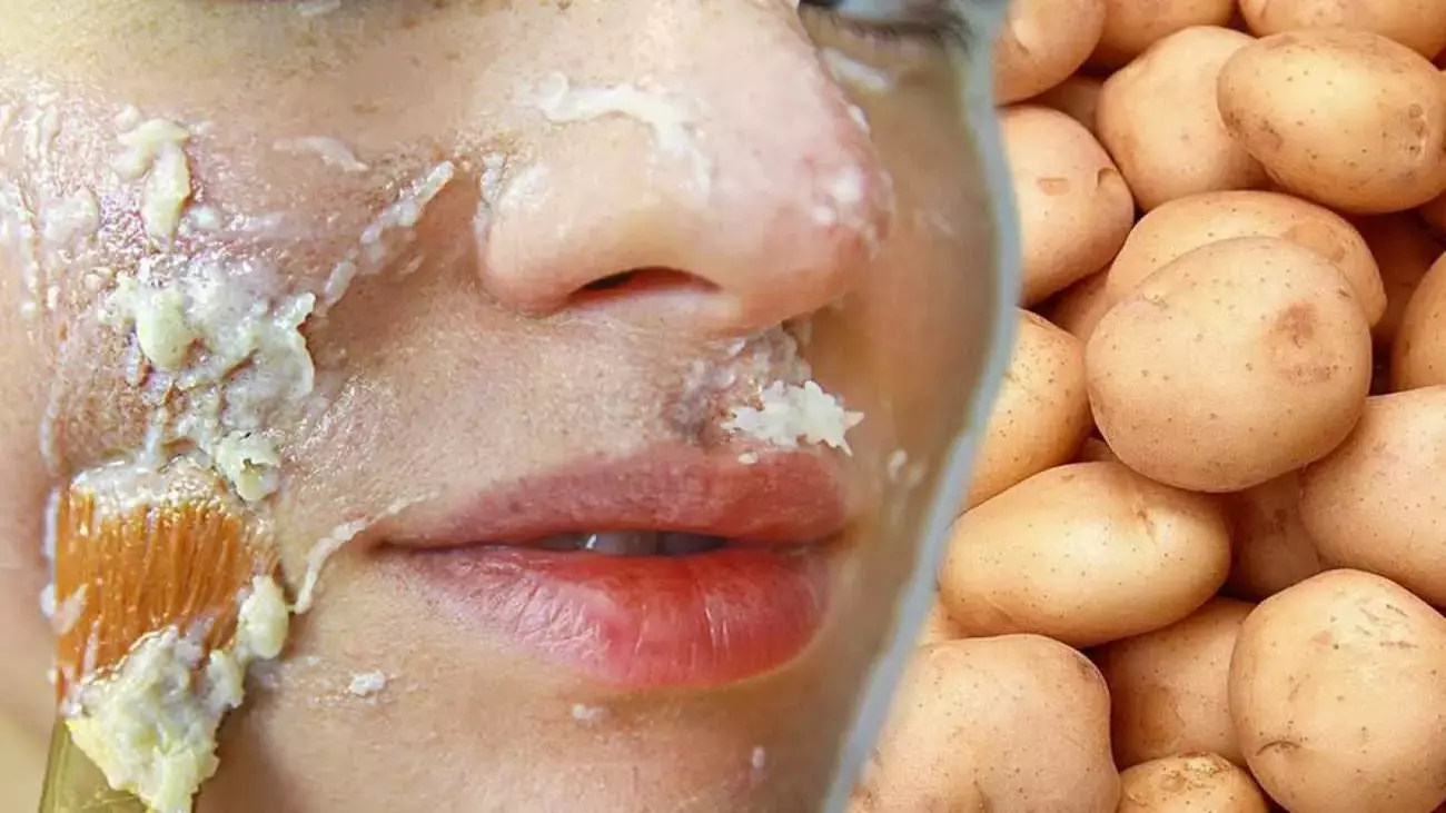 patatesin-cilde-faydalari-nelerdir-patates-yuze-surulur-mu-cilt-bakiminda-patatesin-kullanimi-1632217096-7369