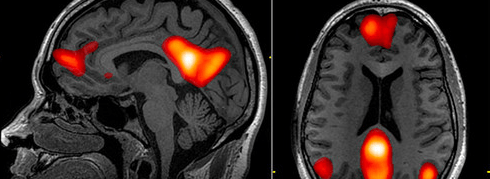 blog-header-image-mri-of-brain-002